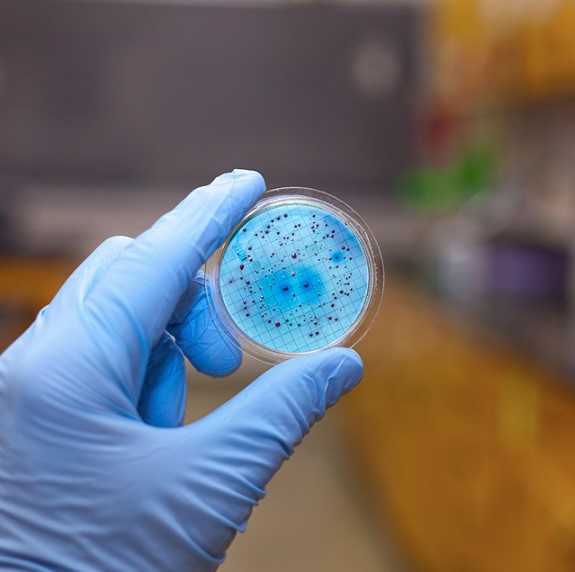 A hand in blue gloves holding a container with a bacteria sample showing electrostatic charge